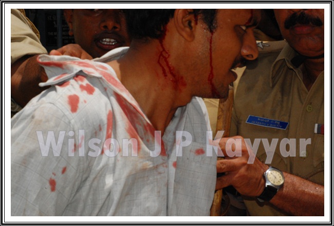 ನಾಂವ್ ಉರಂವ್ಕ್ ಝುಜ್ತಾ , ನಾಂವ್ ನಾಸ್ತಾನಾ ವೆಚೊ ಸಮುದಾಯ್ ? 5 CA002